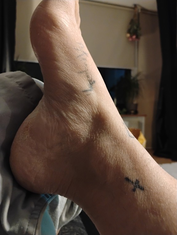 My feet (will get updated weekly