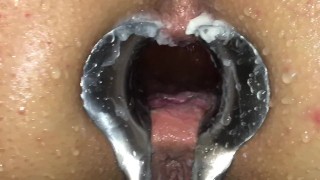 検鏡の小便