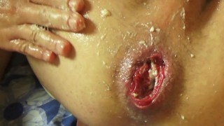 Pompe à pénis avec Hot Fisting Anal