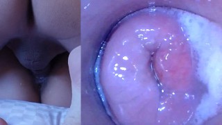 Pussy cum, Cam Chatte!! (Endoscope à l’intérieur de la chatte creampied)