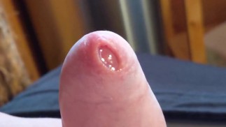 Disparos extremos de primer plano y jugar suavemente con una polla pequeña conduce al semen de una semana de prepucio apretado