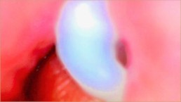 Endoskop-Kamera In Meiner Pinken Pussy Nimmt Auf Wie Er Mich Mit Sperma Füllt💎 - Paar Keyla & Lucas