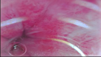Cámara dentro del culo, 9 orgasmos anales palpitante palpitante, latidos del estetoscopio en vivo - Clip completo
